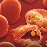 مرض الملاريا MALARIA DISEASE