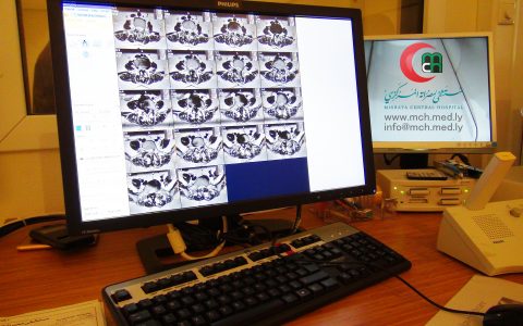 12 فحصاً شعاعياً في “أكتوبر”، 69% منها “X-RAY”