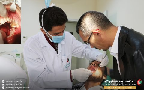 أطباء “الوجه والفكين” ينقذون شاباً من نزيف حاد