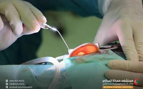 زراعة “4 قواقع” لمرضى من مصراتة و زليتن