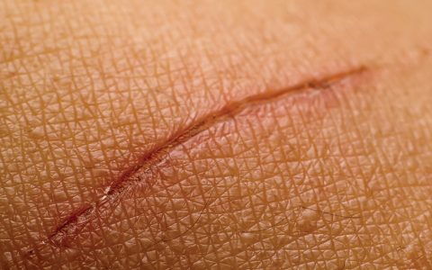 جروح تحت عـدسة المجهر